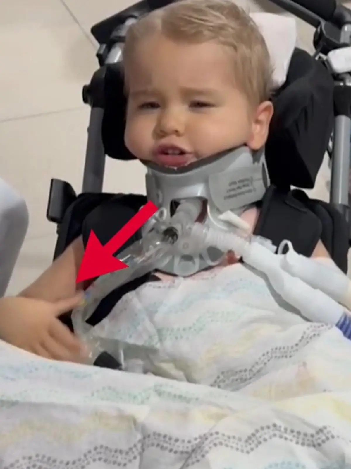 Olli (2) kann seine Hand bewegen!