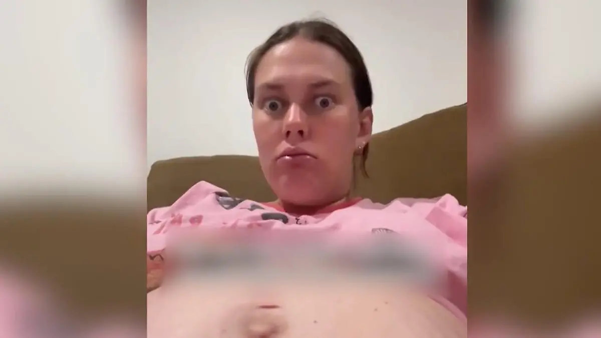 Frau erwartet Zwillinge – aber nur ein Baby ist ihr leibliches Kind! Seltene Schwangerschaft