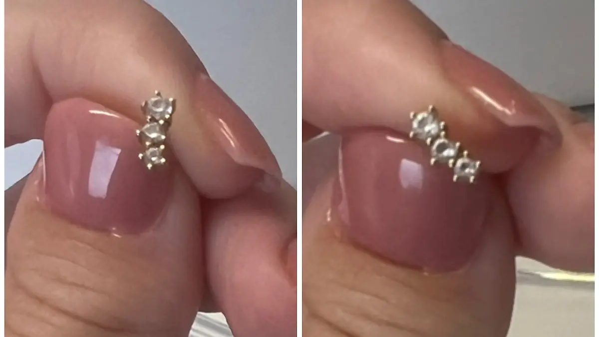 Links ist das Vorher-Bild des Ohrrings, rechts das Nachher-Bild mit dem Gerät von kunphy.