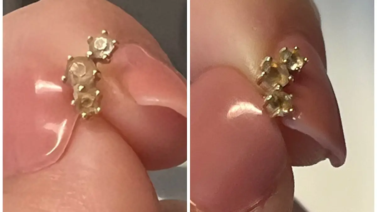 Links ist das Vorher-Bild des Ohrrings, rechts das Nachher-Bild mit dem Gerät von LifeBasis.