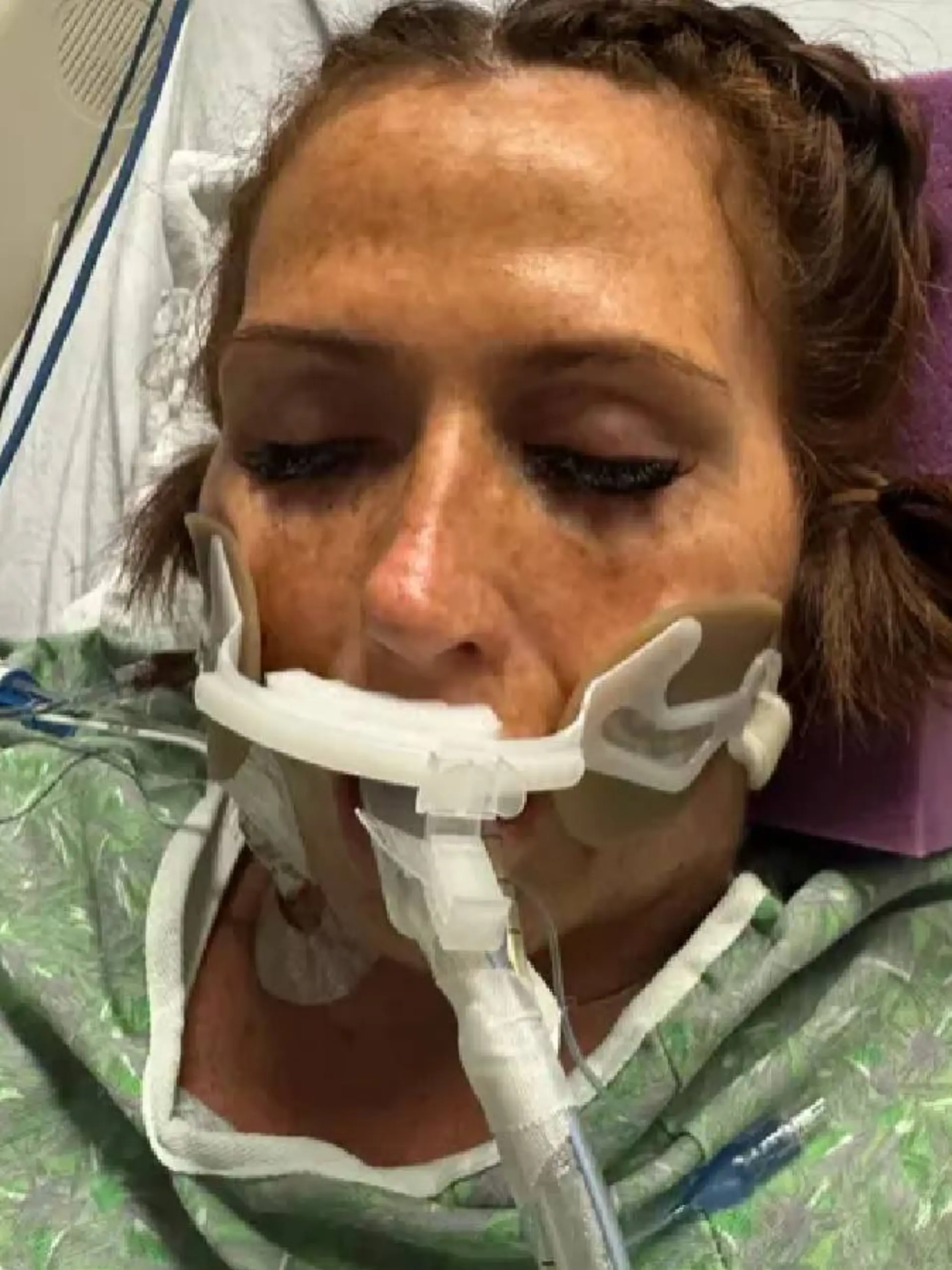 Genevieve Gallagher hat sich mit Vibrio vulnificus infiziert. 