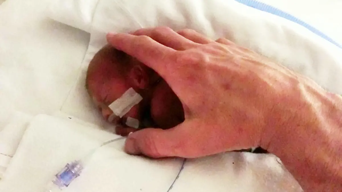 Sonderhonorar! Jett Morris: Ärzte rieten seinen Eltern zur Abtreibung - heute ist er ein Jahr alt! - Jett Morris pictured just after he was born at Queen Alexandra Hospital, Portsmouth. See MASONS story MNMIRACLE: A couple who claim they were pressured to abort her 'non-viable' unborn baby son are celebrating his first birthday after proving doctors wrong. Little Jett (corr) Morris survived for five weeks in the womb after his mum's waters broke when she was just 20 weeks pregnant. He was born at 25 weeks weighing just 1.4lbs - less than a bag of sugar - and has now grown into a healthy one year-old. But parents Mhairi and Paul say their baby boy would not be here today if they had succumbed to pressure from medics to terminate the pregnancy.