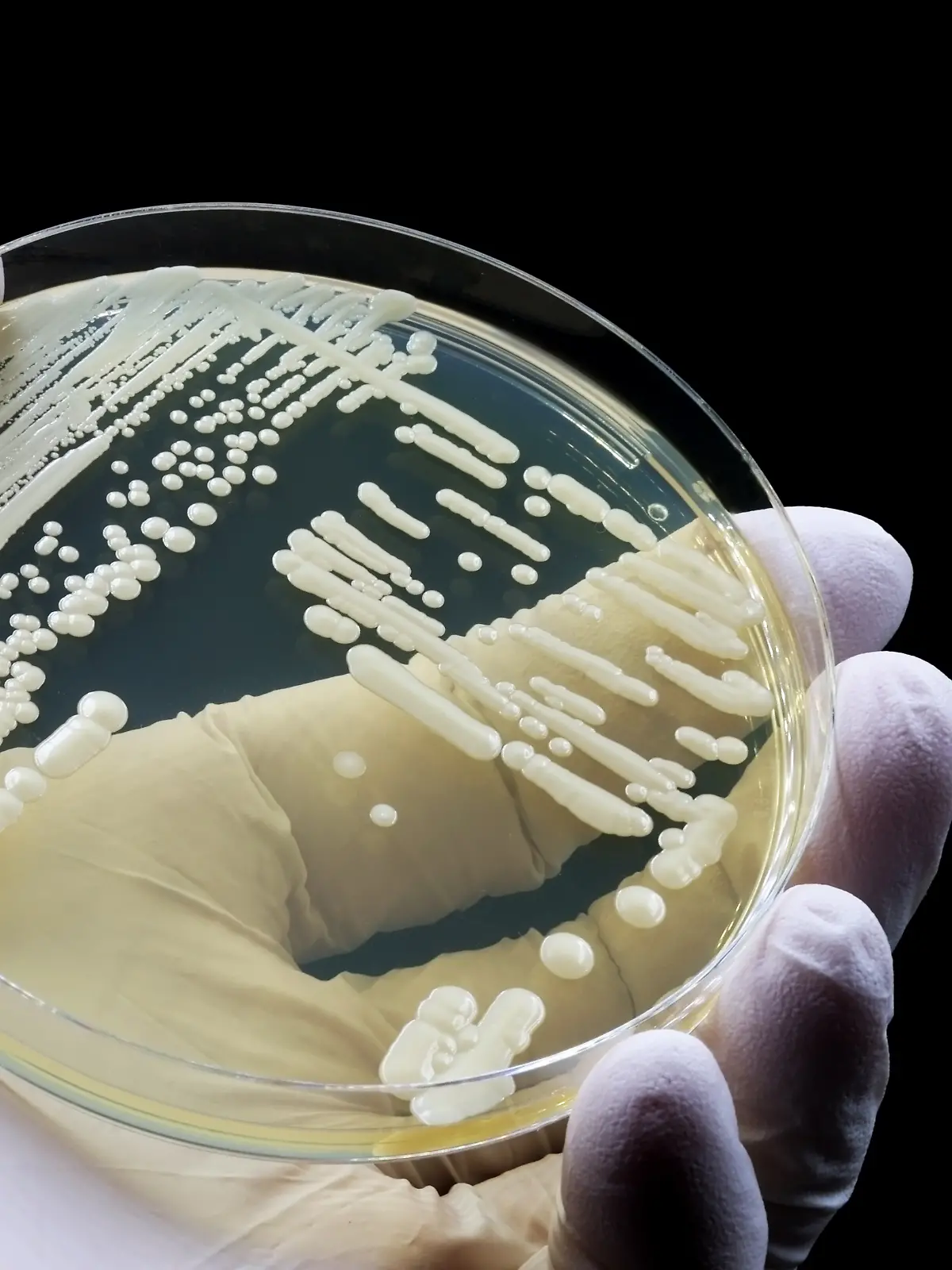 Hefepilz Candida auris heißt jetzt Candidozyma auris. Hefepilz breitet sich wieder aus.