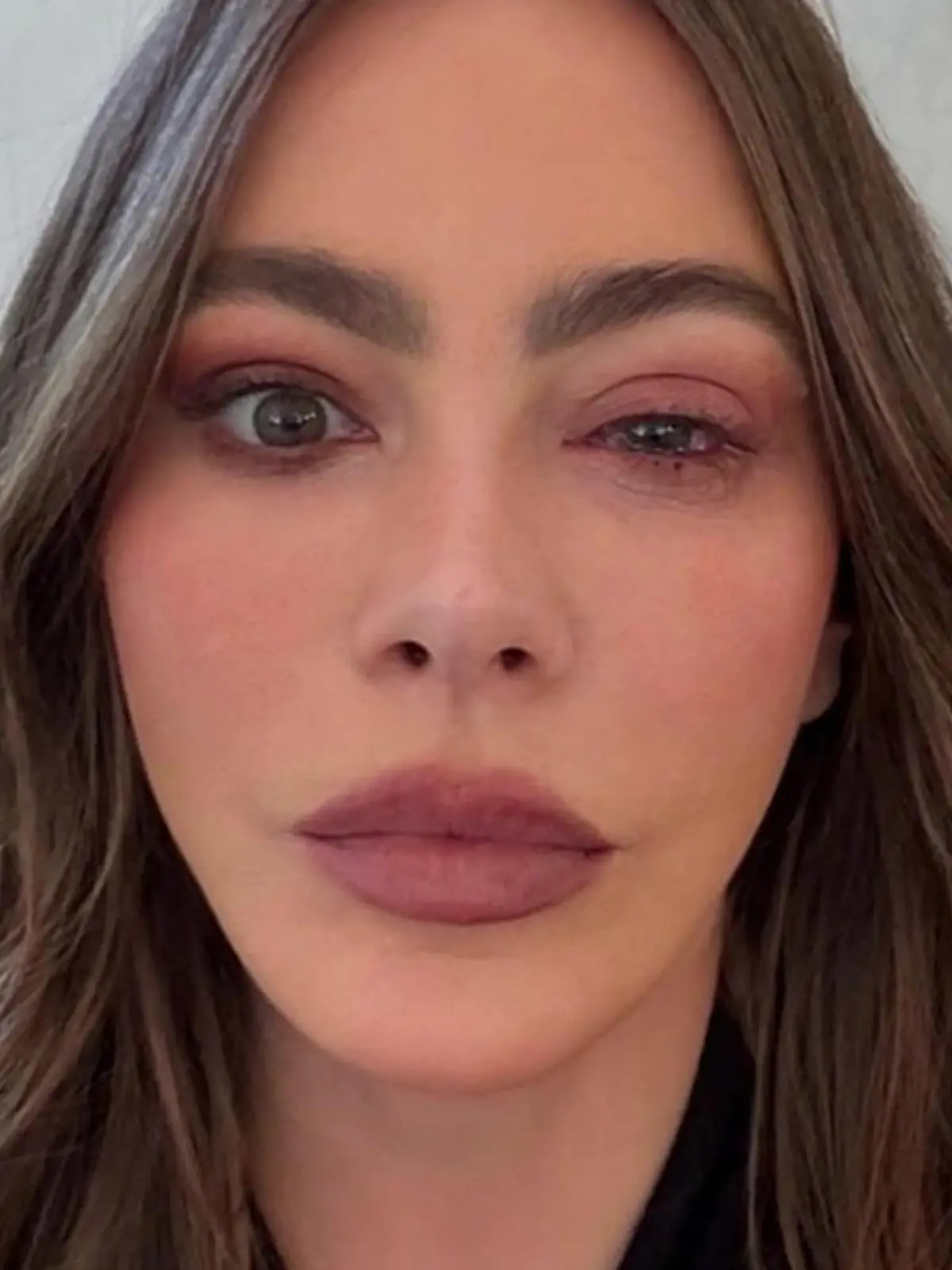 Bild zu: "Mit geschwollenem Auge! Schauspielerin Sofia Vergara landet in Notaufnahme"