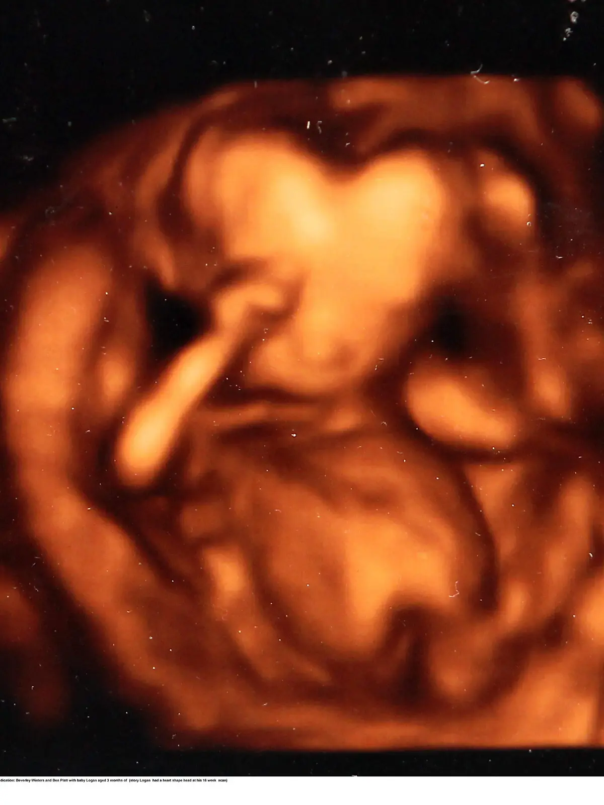 Beverley Winters and Ben Platt with baby Logan aged 3 months of  (story Logan  had a heart shape head at his 16 week  scan)  
Pic from MEN Syndication

Mitchell Henry House
Hollinwood Avenue
Chadderton
Oldham
OL9 8EF
syndication@men-news.co.uk