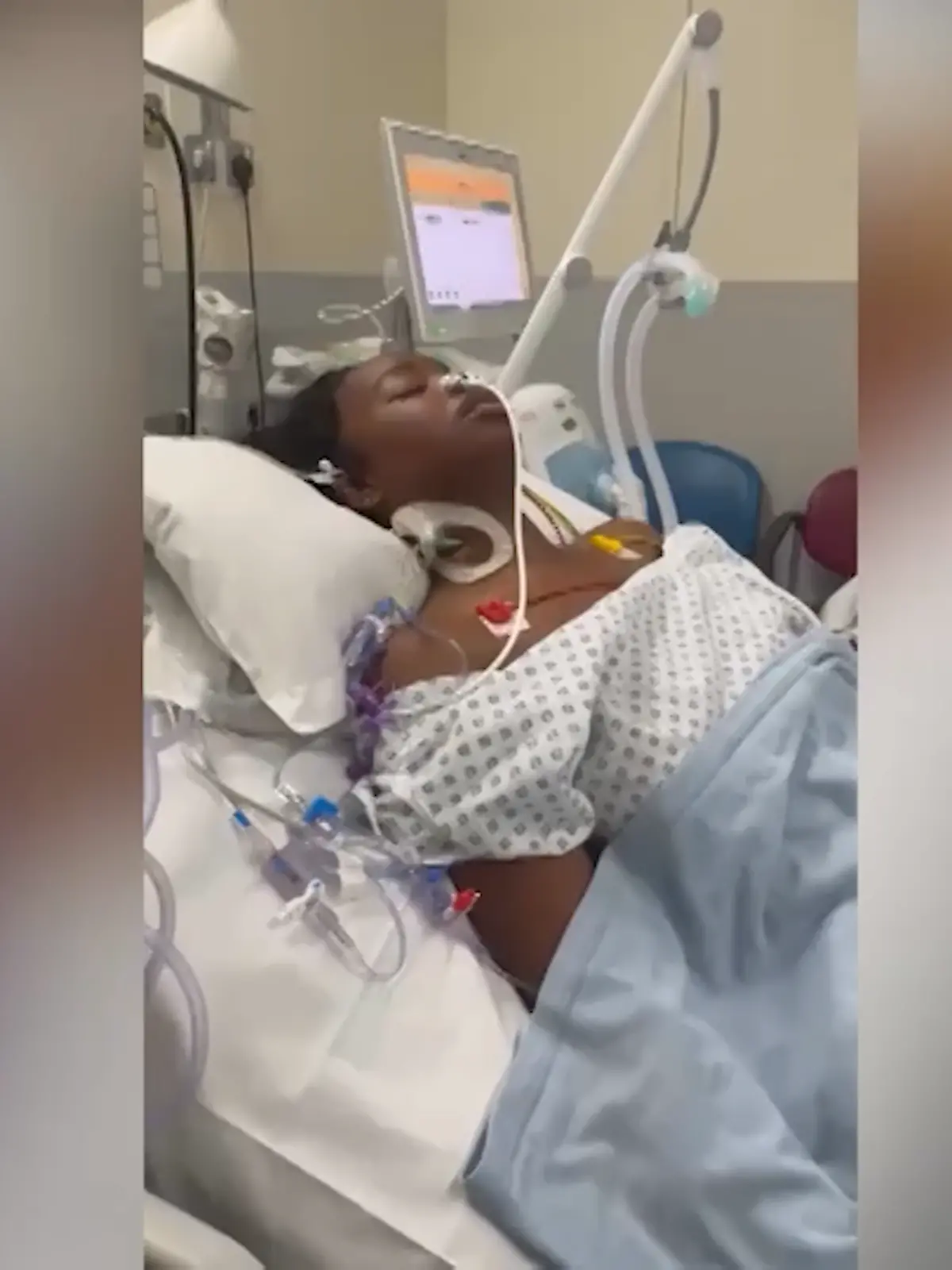 Bild zu: "Studentin (19) hat Grippesymptome – eine Woche später verliert sie Beine und Finger "