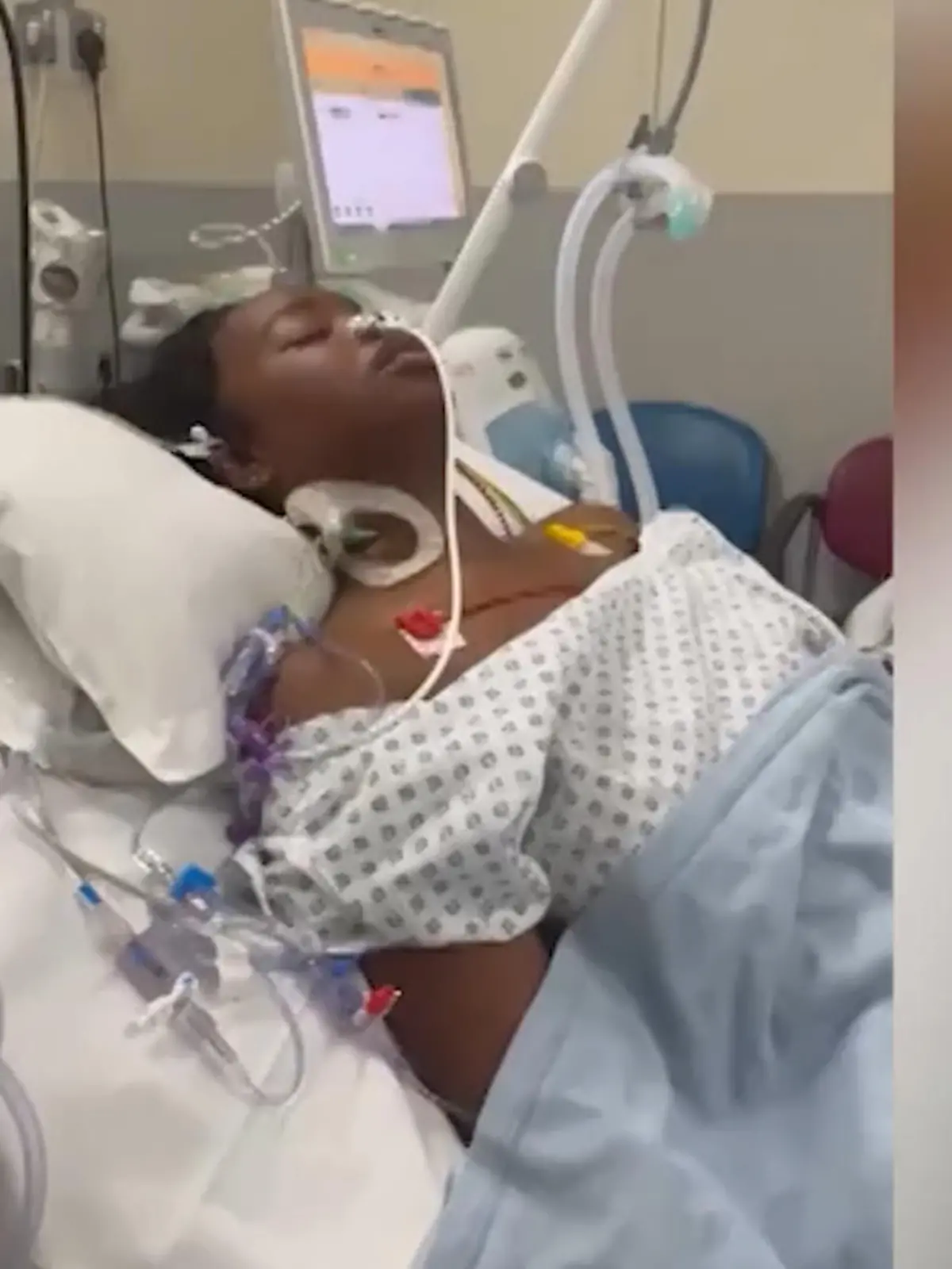 Bild zu: "Ketia (19) hat Grippesymptome – eine Woche später verliert sie Beine und Finger"