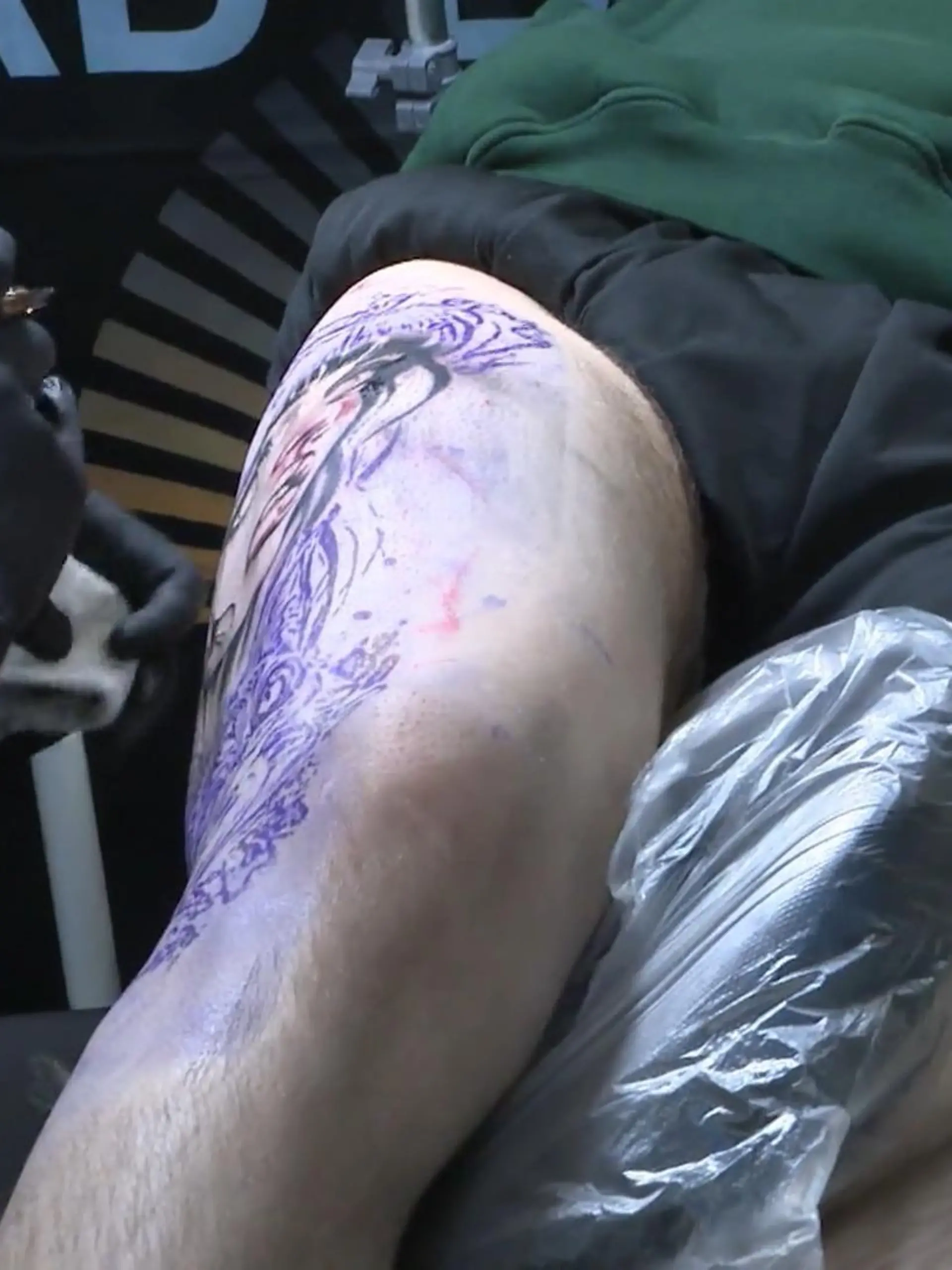 Bild zu: "Schützen Tattoos vor Hautkrebs?"