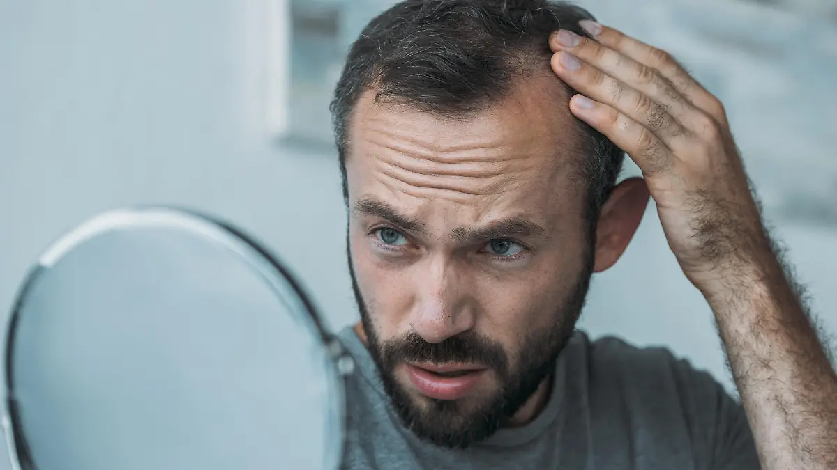 Mann untersucht seine fehlenden Kopfhaare im Spiegel.