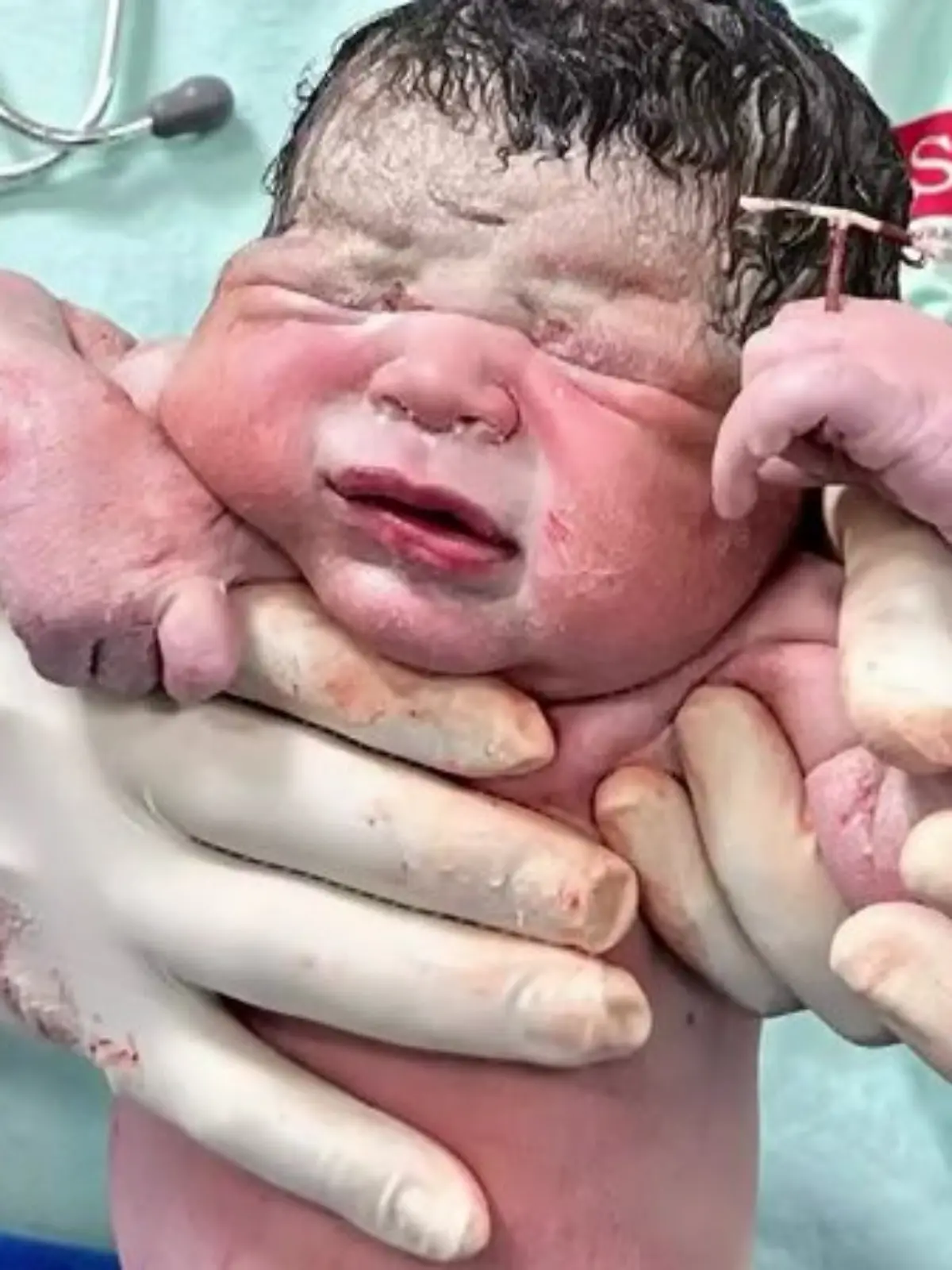 Bild zu: "Ätsch, hier bin ich! Neugeborenes hält Verhütungsspirale der Mutter in der Hand"