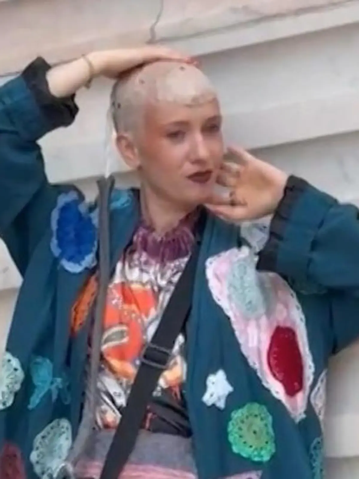 Bild zu: "Harmloses Kribbeln entpuppt sich als Hirntumor! Dieses Gerät hält Sandra jetzt am Leben"