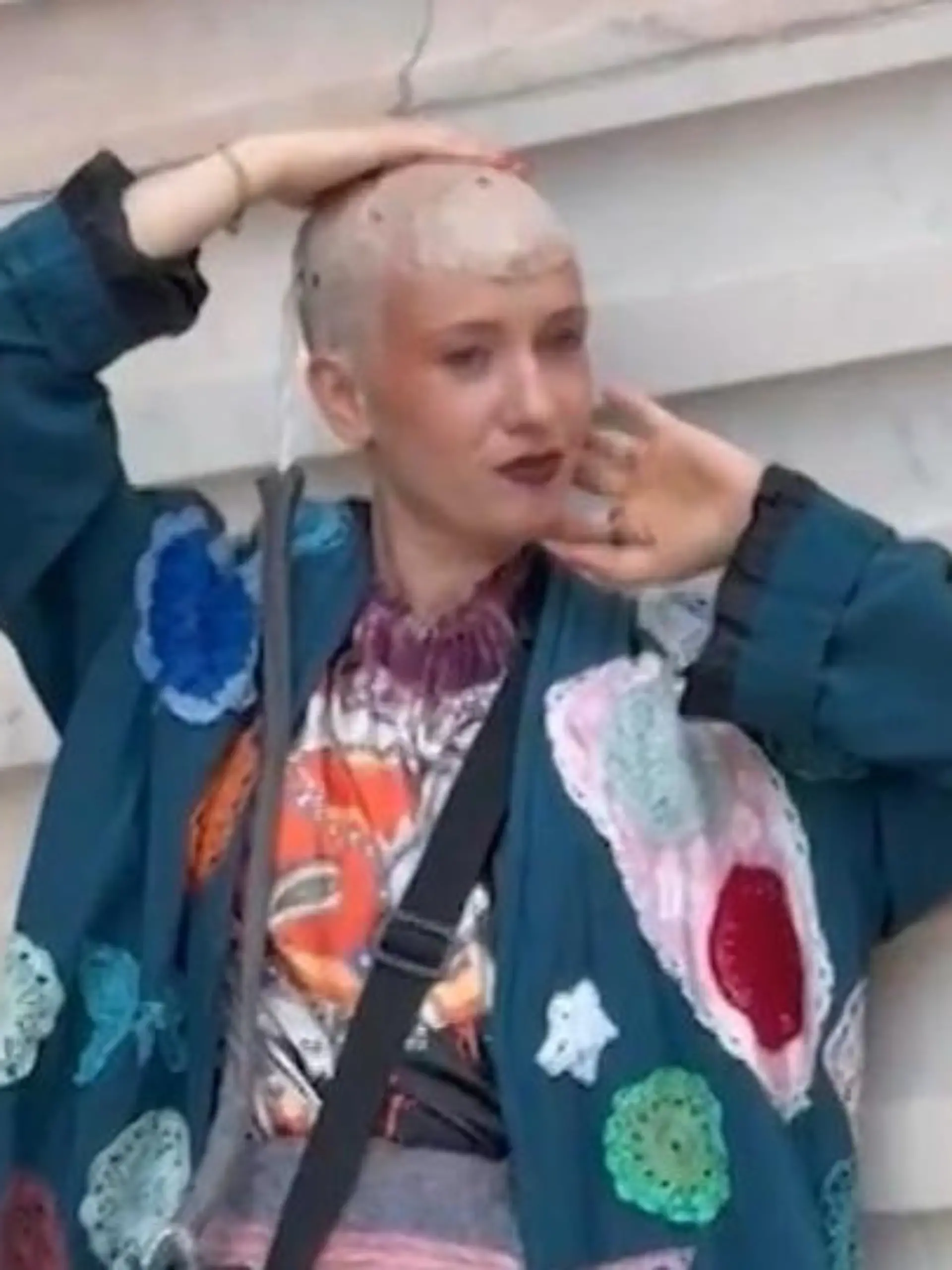 Bild zu: "Harmloses Kribbeln entpuppt sich als Hirntumor! Dieses Gerät hält Sandra jetzt am Leben"