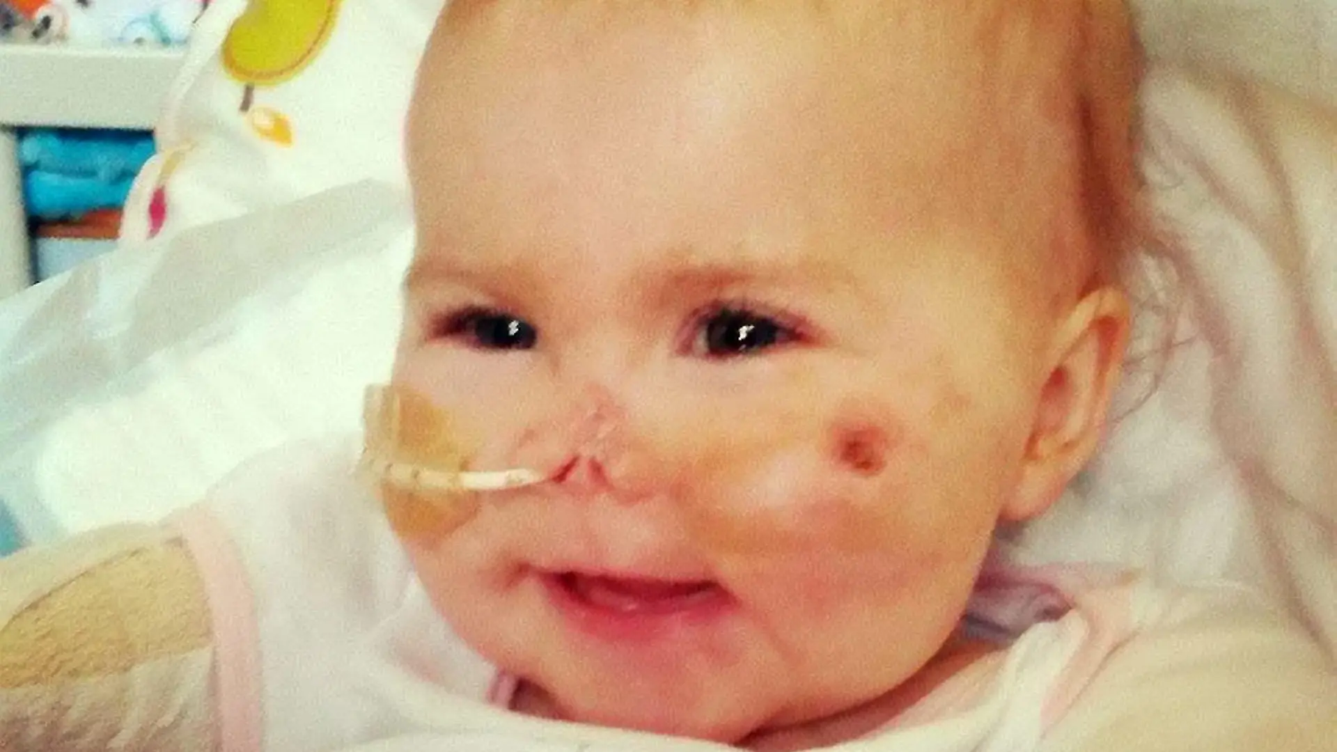 Die kleine Harmonie-Rose lächelt zum ersten Mal, obwohl sie so ein schweres Schicksal hat. - The bravest smile - little Harmonie-Rose Allen shows the incredible coping ability of children by giggling and beaming just days after having all her limbs amputated. See SWNS story SWLIMB: This week little Harmonie-Rose has amazed her family with another breakthrough ? her first smile since going into hospital in September. Mum Freya Hall and dad Ross Allen, from Bath, were delighted to share a photo of Harmonie-Rose smiling with well-wishers on Facebook. The smile came only days after her family explained she might have to learn to smile again due to the way meningitis affects the brain. Her first smile was on Sunday afternoon to Freya, she smiled at Ross on Monday and since Tuesday she has been full of smiles.