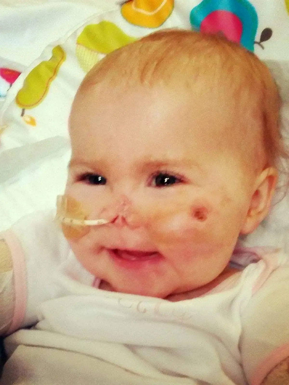 Die kleine Harmonie-Rose lächelt zum ersten Mal, obwohl sie so ein schweres Schicksal hat. - The bravest smile - little Harmonie-Rose Allen shows the incredible coping ability of children by giggling and beaming just days after having all her limbs amputated.  See SWNS story SWLIMB: This week little Harmonie-Rose has amazed her family with another breakthrough ? her first smile since going into hospital in September. Mum Freya Hall and dad Ross Allen, from Bath, were delighted to share a photo of Harmonie-Rose smiling with well-wishers on Facebook. The smile came only days after her family explained she might have to learn to smile again due to the way meningitis affects the brain. Her first smile was on Sunday afternoon to Freya, she smiled at Ross on Monday and since Tuesday she has been full of smiles.