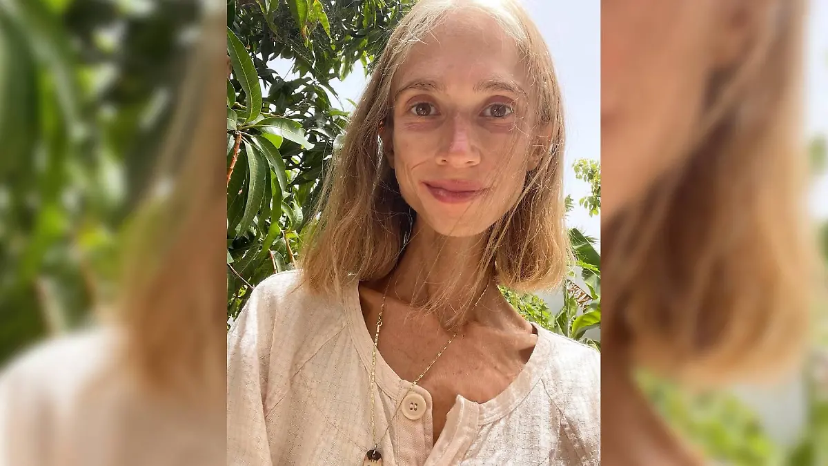 Karolina K. (†27) stirbt an Mangelernährung