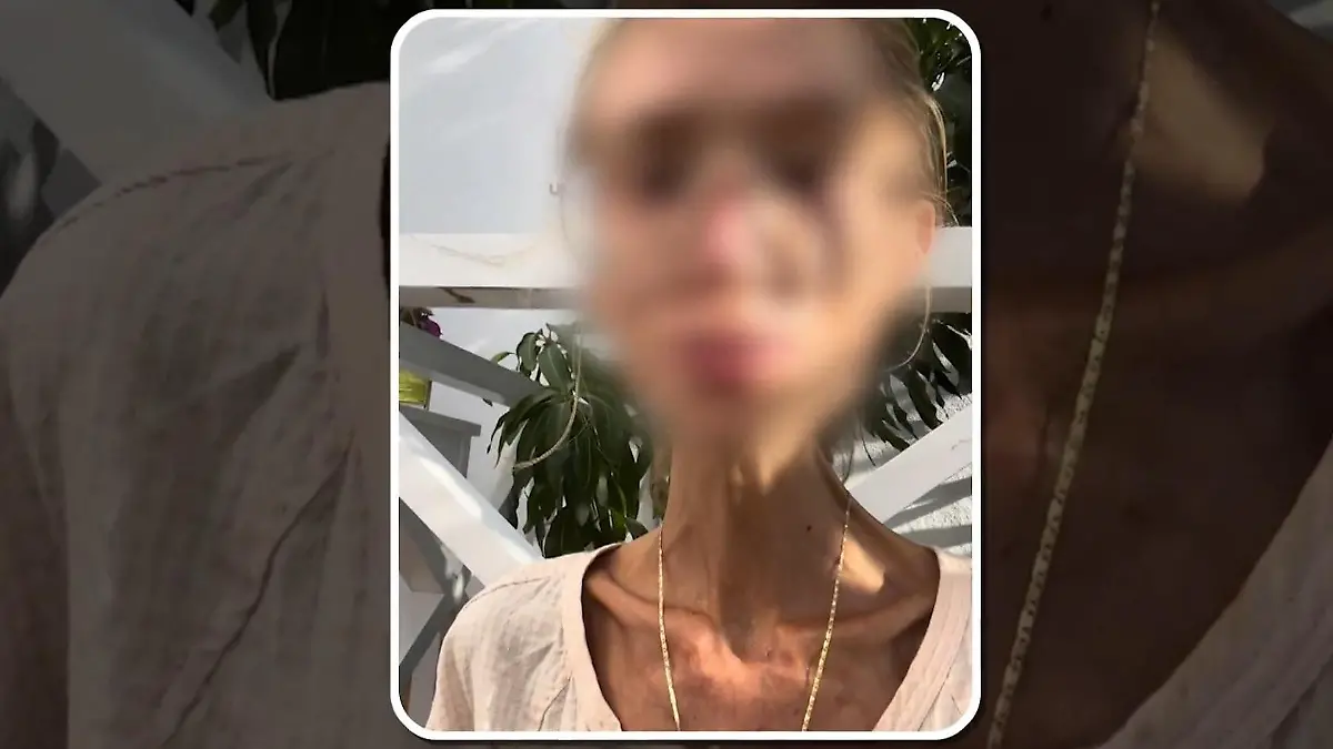 Sie wog keine 30 Kilo mehr! Karolina (†27) stirbt nach Frucht-Diät Ist sie verhungert?