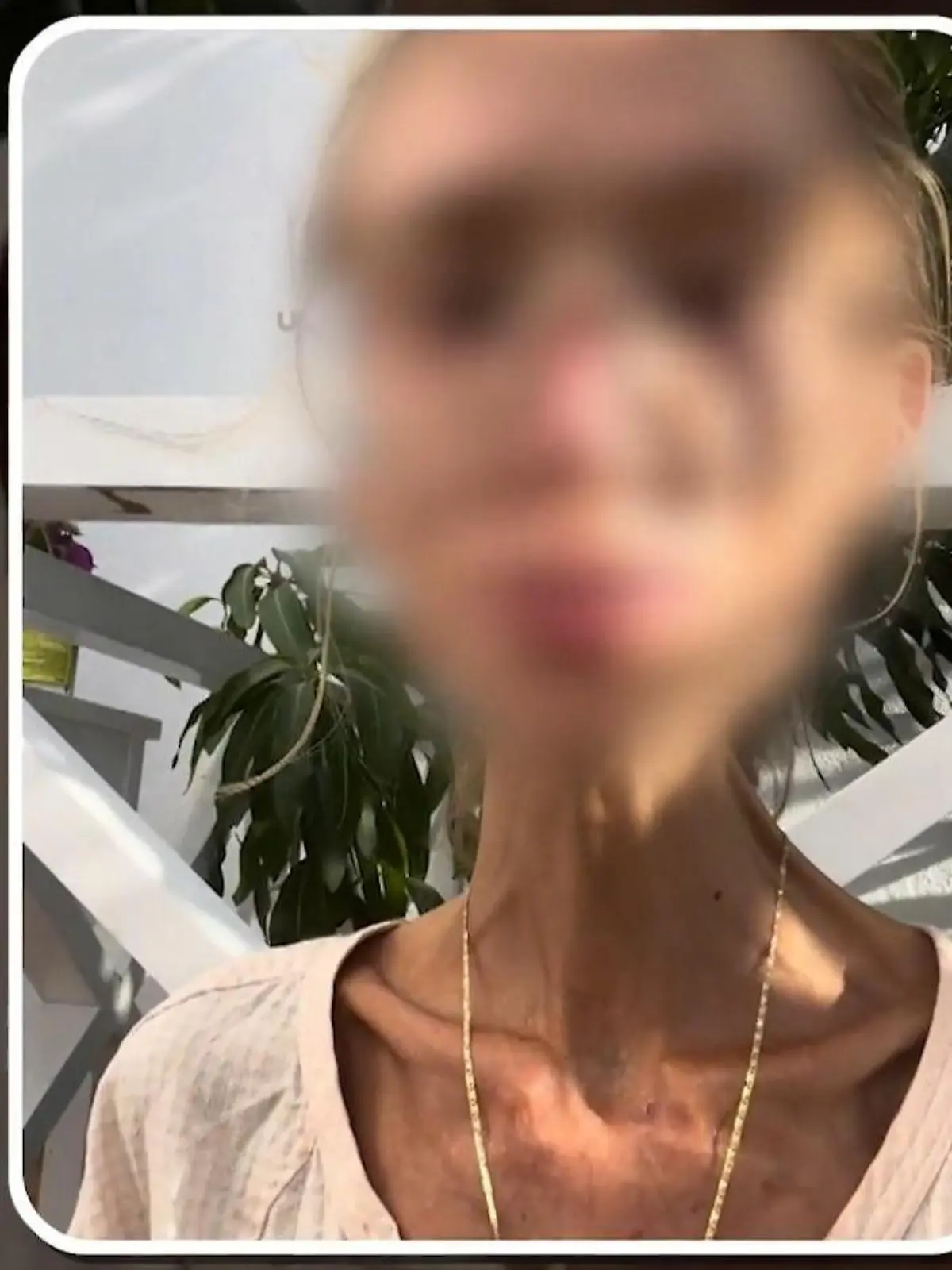 Bild zu: "Sie wog keine 30 Kilo mehr! Karolina (†27) stirbt nach Frucht-Diät"