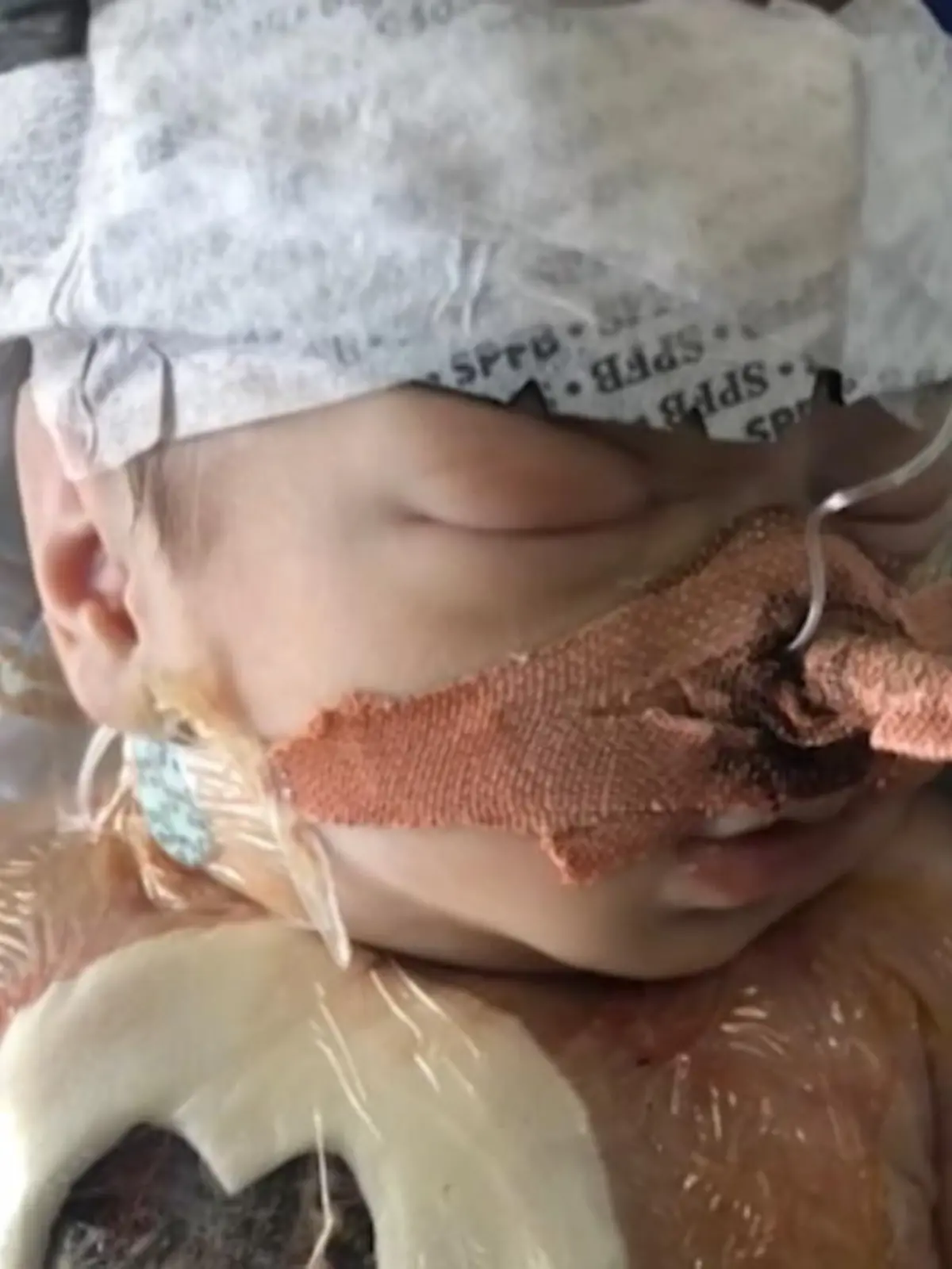 Baby Dorothea aus Sussex in England überlebt einen angeborenen Herzfehler trotz geringer Überlebenschance und Herzstillstand. Ihre Eltern kämpfen mit Spenden für die Operation. Ein absolutes Wunder, mit dem die Eltern den Menschen zeigen wollen, dass es sich lohnt zu kämpfen und niemals aufzugeben.