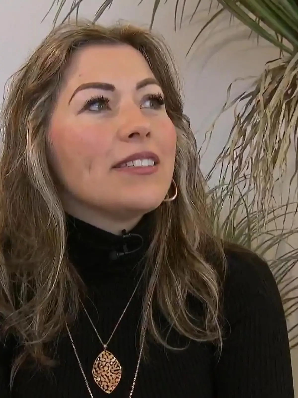 Bild zu: "Sandra hatte einen schlimmen Sportunfall"