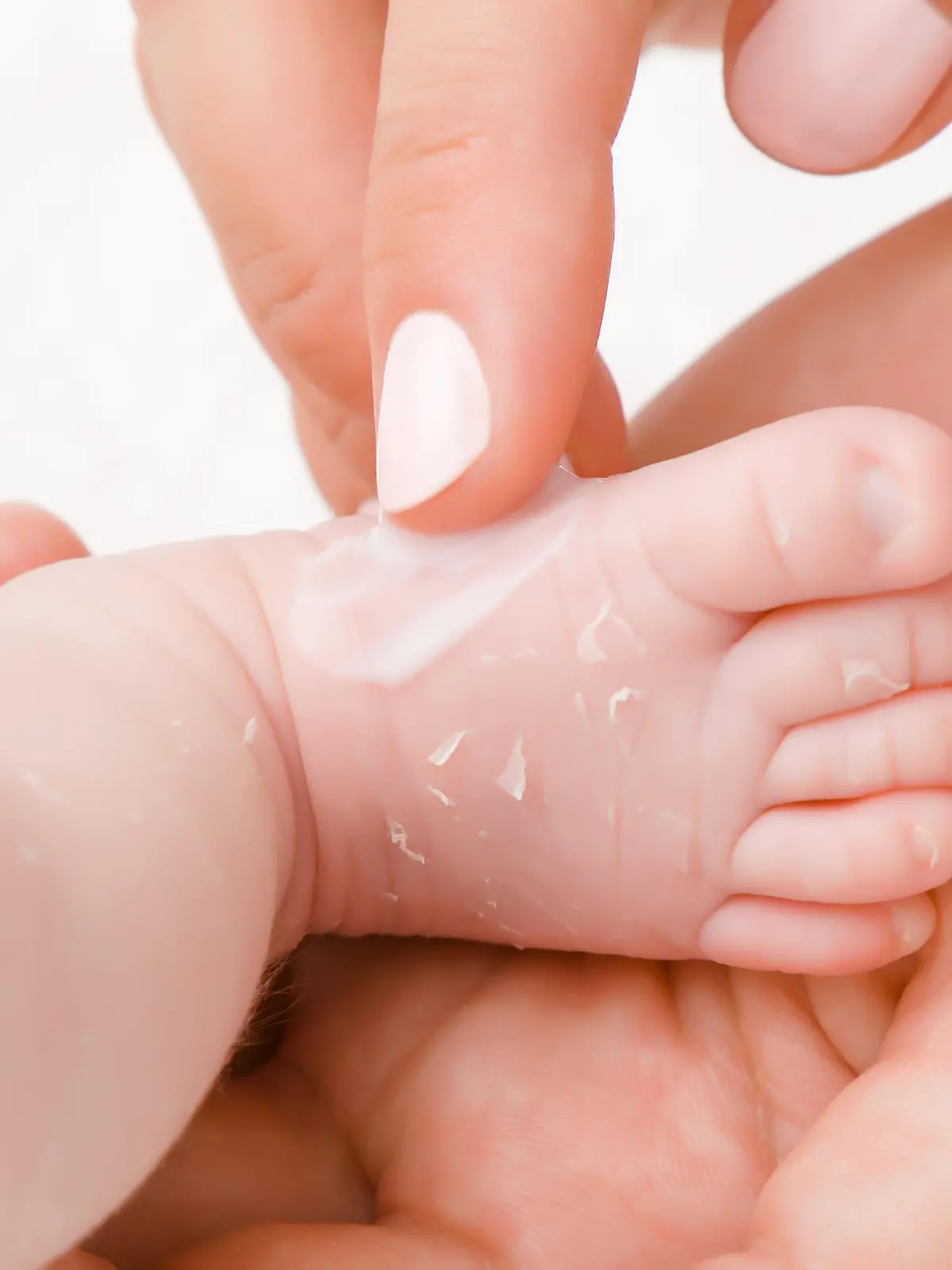Mutter trägt Creme auf trockene Babyhaut auf