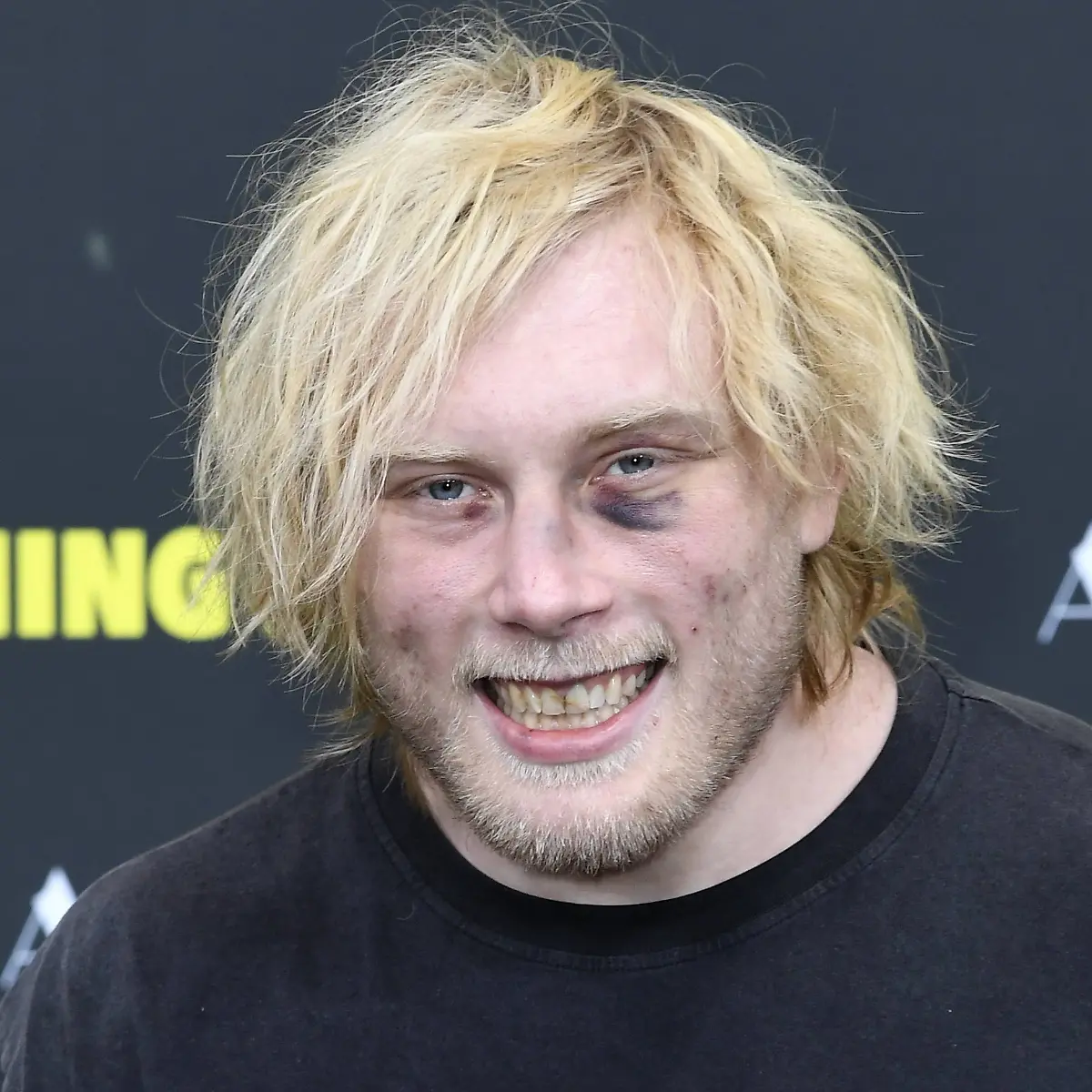 Frédéric „Neandertaler” Vosgröne