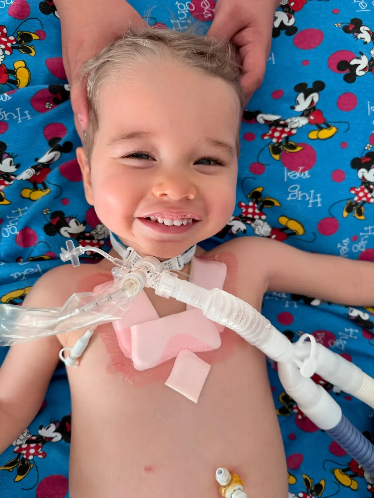 Oliver Staub (2) beginnt, sich von seiner Halskrause zu verabschieden, und soll auch vom Beatmungsgerät wegkommen. Eine experimentelle Stammzellentherapie soll gegen die Lähmung helfen.