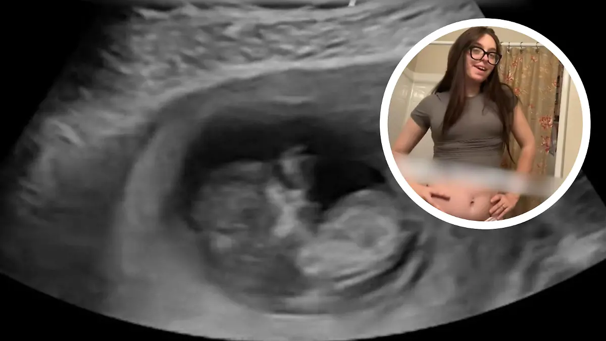 Bild zu: "Erdbeben im Bauch! Wenn Mama lacht, passiert mit dem Baby DAS"