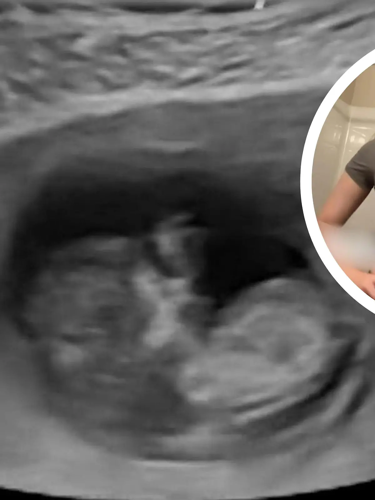 Bild zu: "Erdbeben im Bauch! Wenn Mama lacht, passiert mit dem Baby DAS"