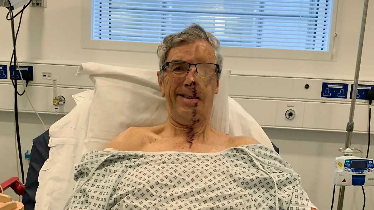 Dave Richards bekam nach einem schweren Unfall im Rahmen seiner Behandlung eine 3D-Prothese für sein Gesicht