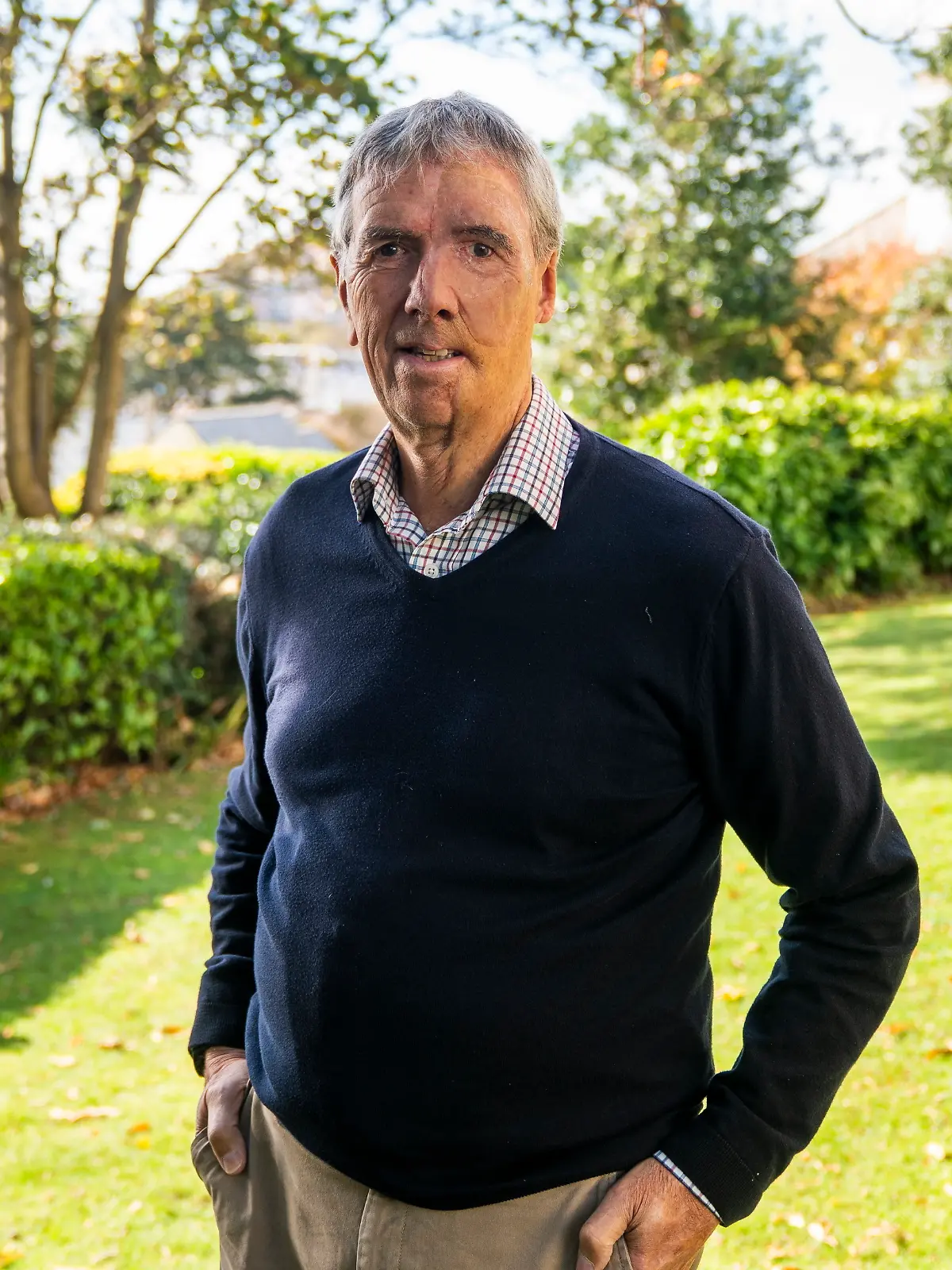 Dave Richards bekam nach einem schweren Unfall im Rahmen seiner Behandlung eine 3D-Prothese für sein Gesicht