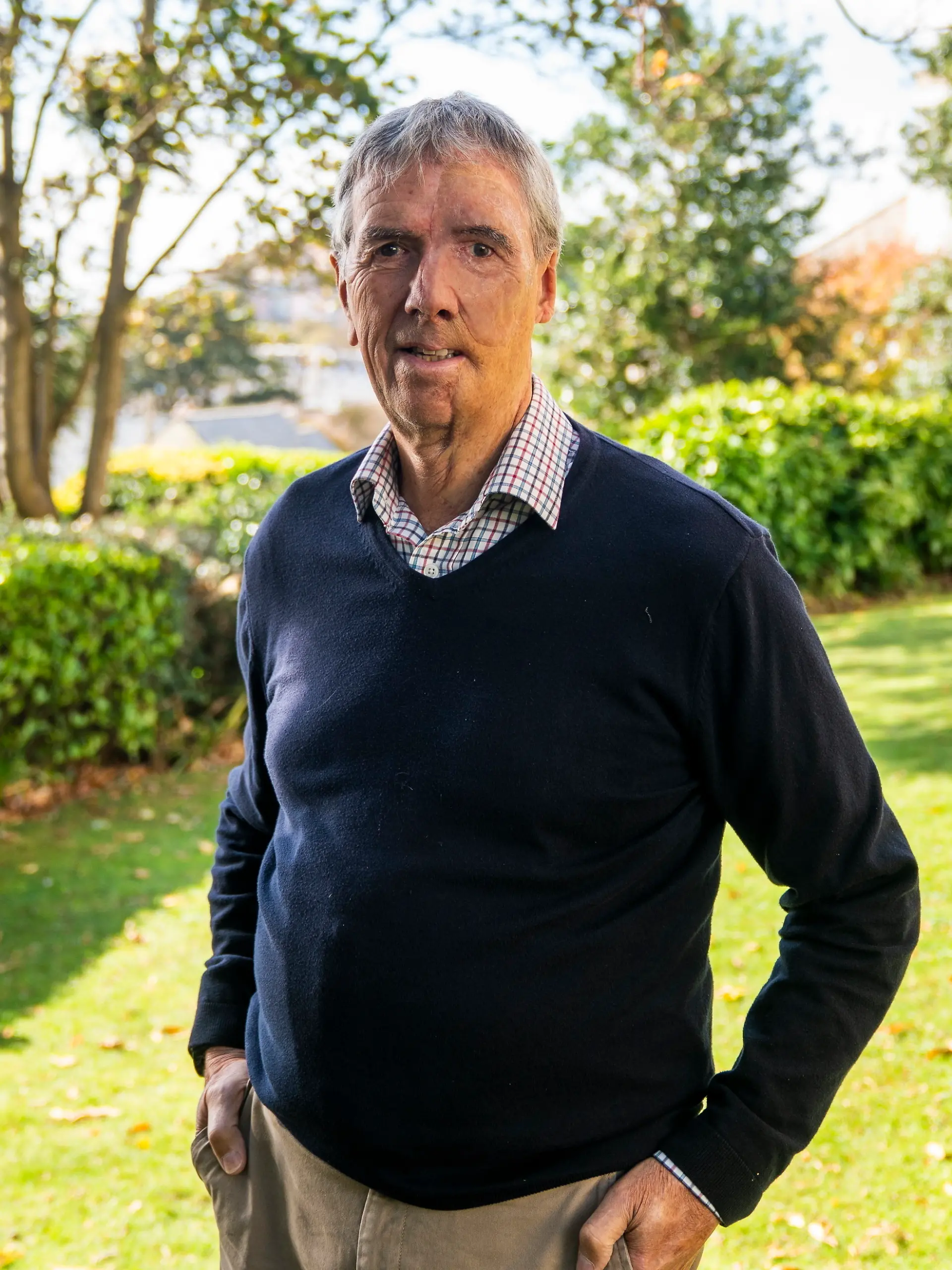 Dave Richards bekam nach einem schweren Unfall im Rahmen seiner Behandlung eine 3D-Prothese für sein Gesicht
