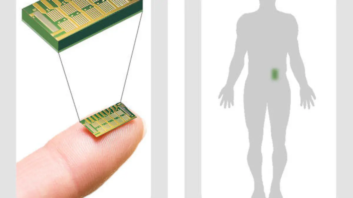 SPERRFRIST 15.02.2012 20.00 Uhr - Das undatierte Handout des Massachusetts Institute of Technology (MIT) in Cambridge zeigt die Darstellung eines Microchips, wie er jetzt bei Osteoporose-Patientinnen getestet wurde. Wie das Forscherteam mitteilte, war die Wirkung des Medikaments aus dem Chip vergleichbar mit der Wirkung des Mittels nach dem Spritzen. Foto: MIT/dpa ACHTUNG: Nur zur redaktionellen Verwendung und im Zusammenhang mit der Berichterstattung über den Medizin-Mikrochip! (Zu dpa 0605 vom 15.02.2012)