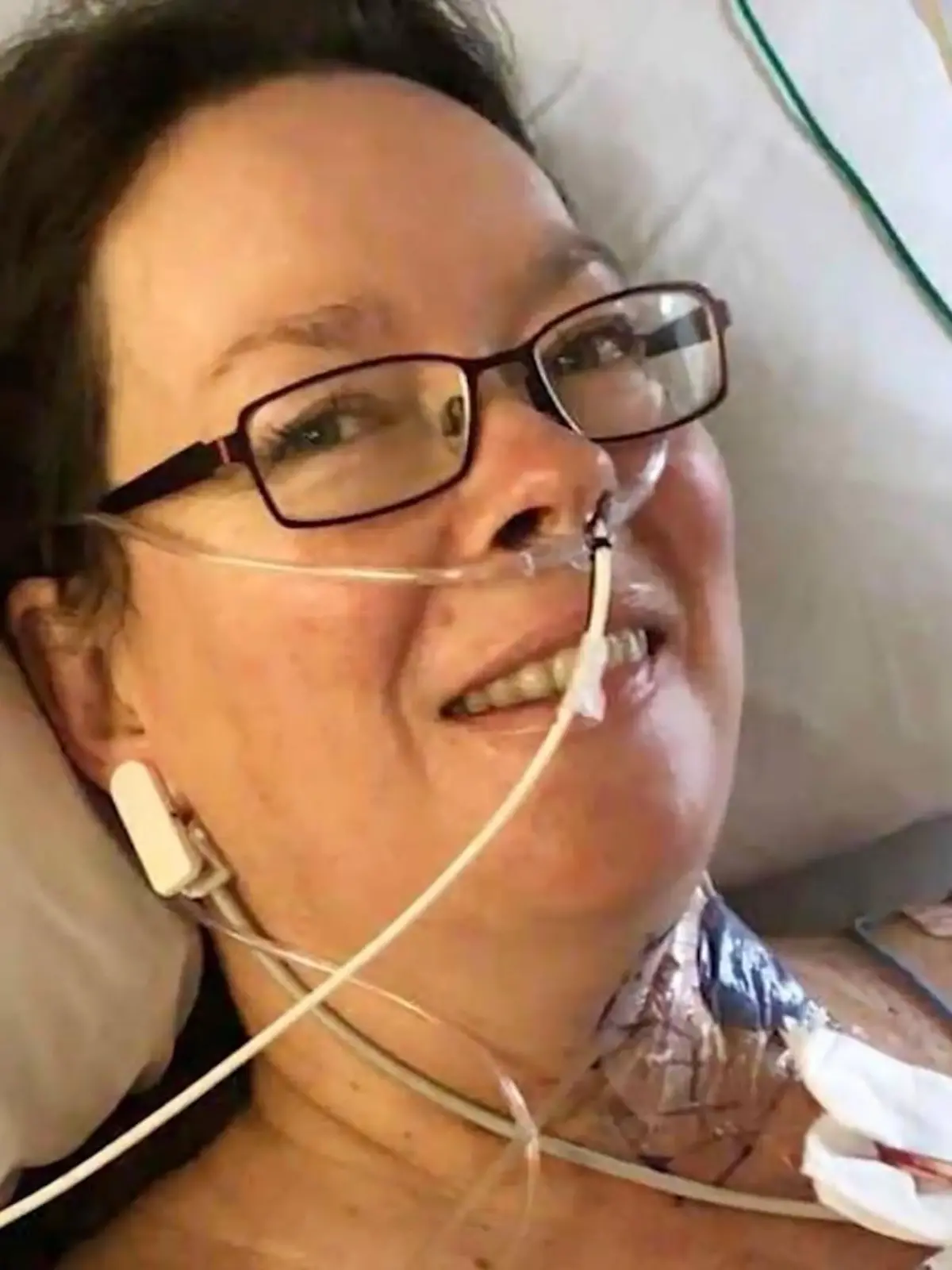 Bild zu: "Mundkrebs frisst ihre Zunge! Ärzte retten Candi (52) mit ungewöhnlicher OP"