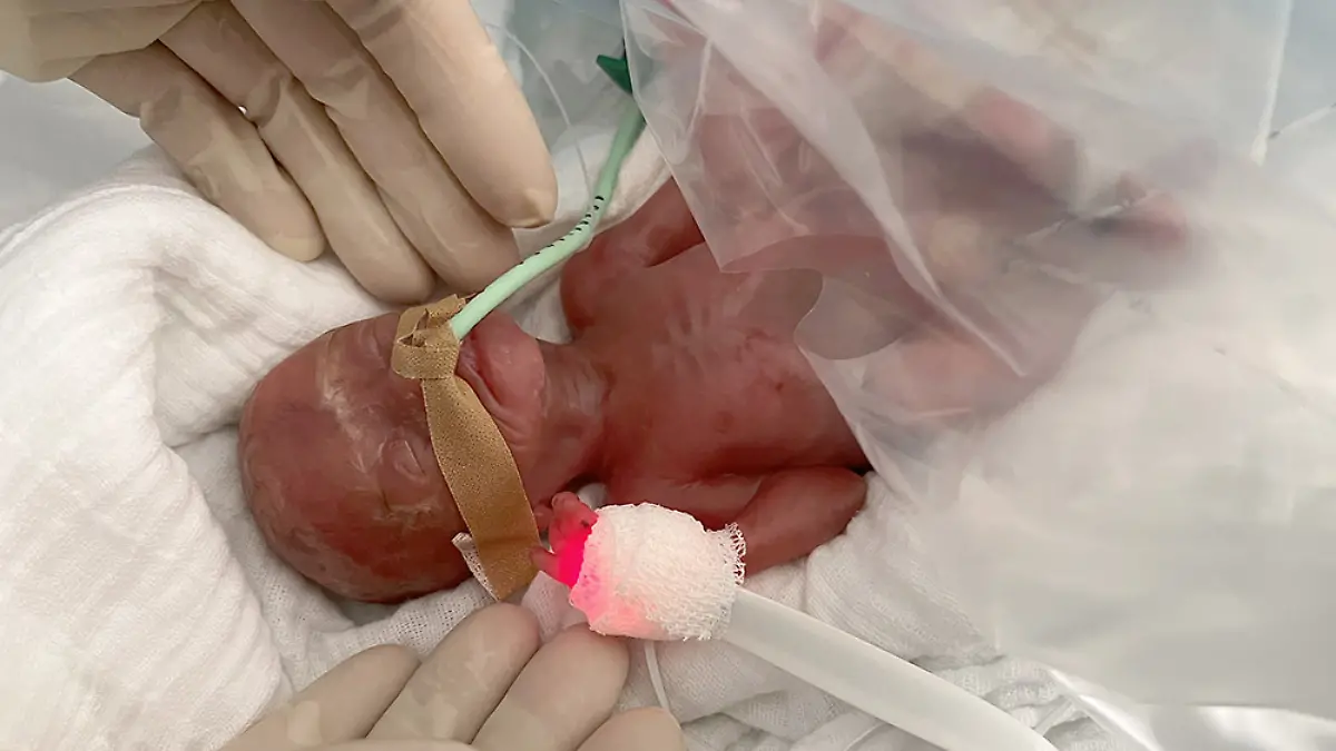 Universitätsklinikum Magdeburg - 300 Gramm Frühchen