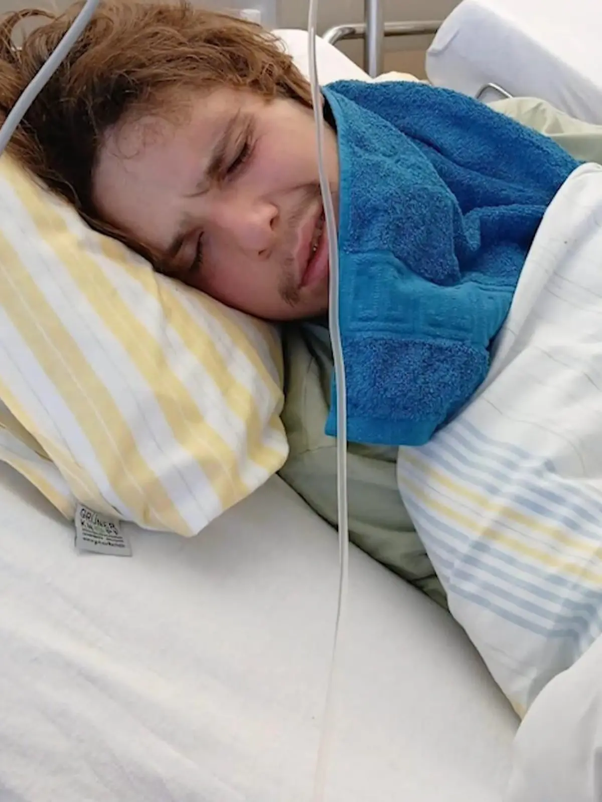 Bild zu: "Schädel-Hirn-Trauma nach Party-Nacht"