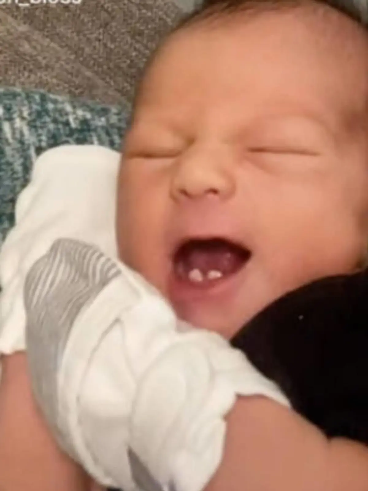 Jordan Bloss-Wilsons Sohn Dawson hat von Geburt an zwei Zähnchen.
