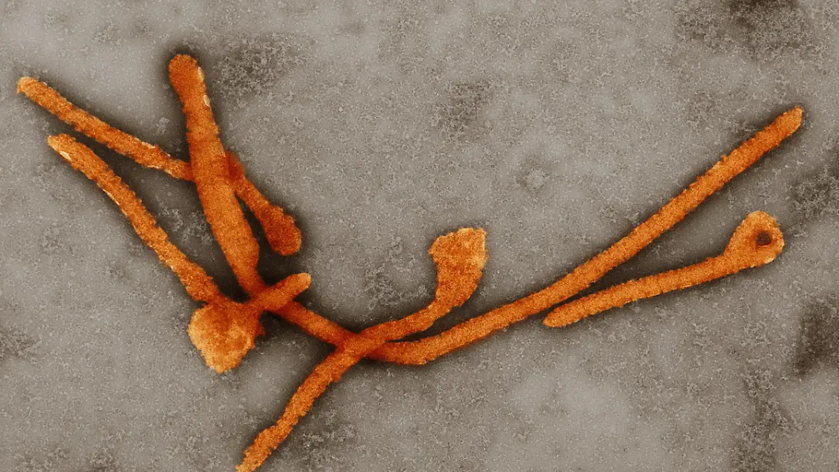 HANDOUT - Elektronenmikroskopische Aufnahme von Ebolaviren (Filoviridae, Orange eingefärbt) in 10000-facher Vergrößerung. Die Ebola-Epidemie in Westafrika ist die schwerste, die bisher registriert wurde. Foto: Hans Gelderblom/RKI/Koloriert von Andrea Schnartendorff (ACHTUNG: Verwendung nur für redaktionelle Zwecke im Zusammenhang mit der Berichterstattung über Ebola und nur bei Urheber-Nennung Foto: Hans Gelderblom/RKI/Koloriert von Andrea Schnartendorff) +++(c) dpa - Bildfunk+++