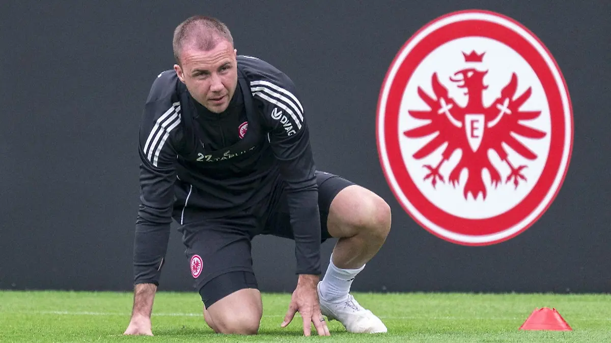 Schön dank Beauty-Eingriff! Fußball-Weltmeister Mario Götze glänzt in neuem Look Nach Haartransplantation