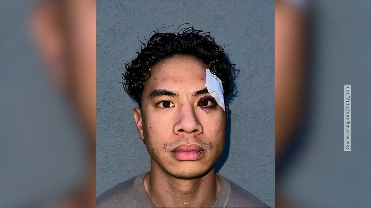 Comedian Tutty Tran berichtet von rassistischem Angriff Warum er trotzdem nicht schweigt