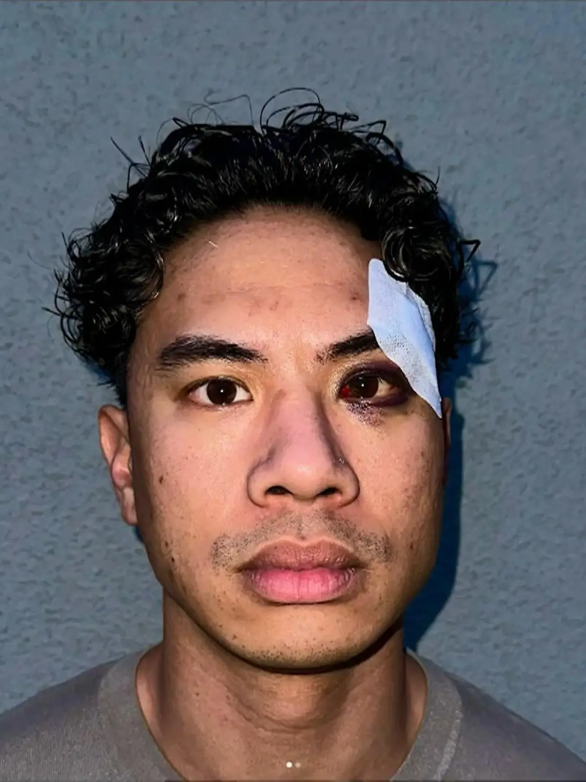 Bild zu: "Comedian Tutty Tran berichtet von rassistischem Angriff"