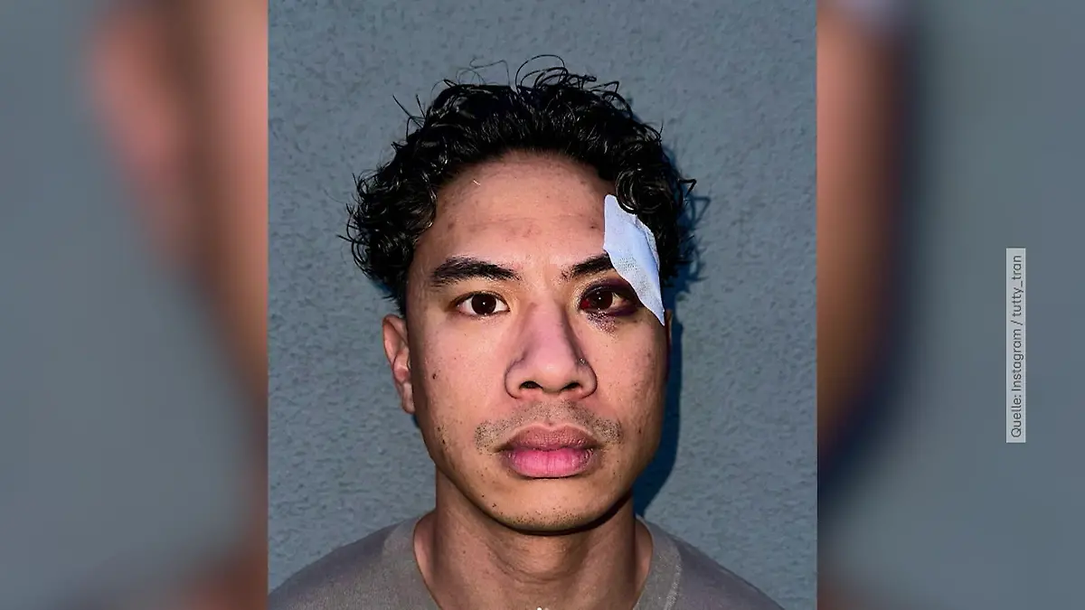 Comedian Tutty Tran berichtet über rassistischen Angriff "Weil ich so aussehe, wie ich aussehe!"