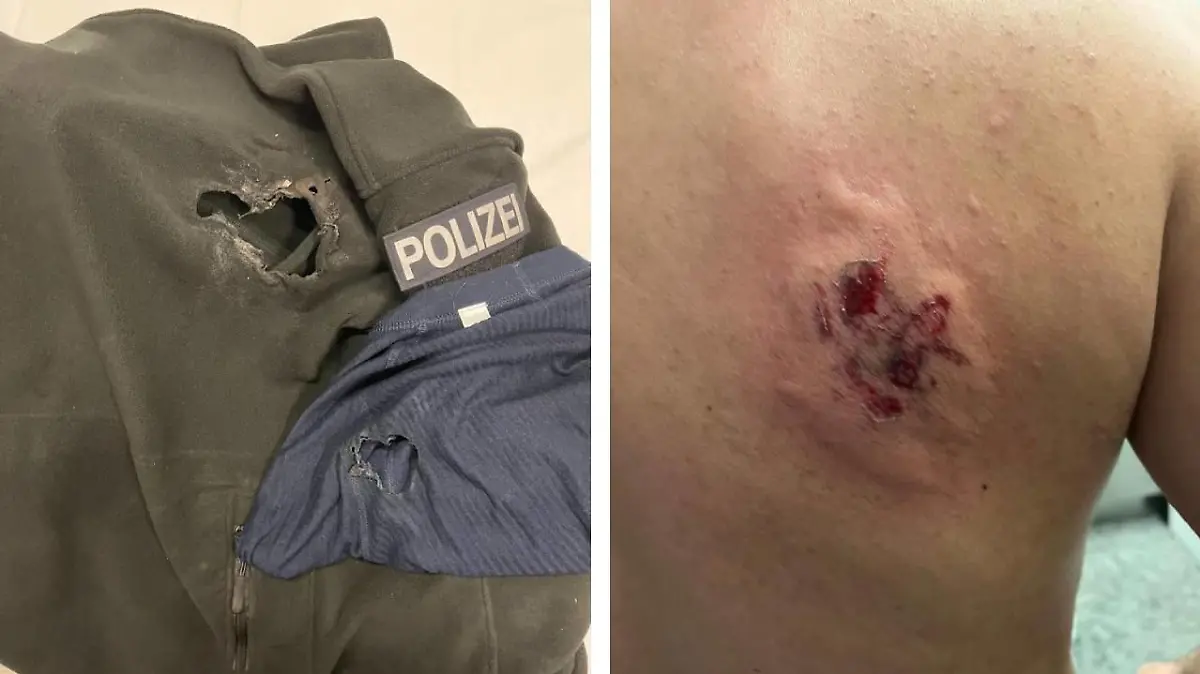 Zahlreiche Polizisten wurden in der Silvesternacht verletzt.