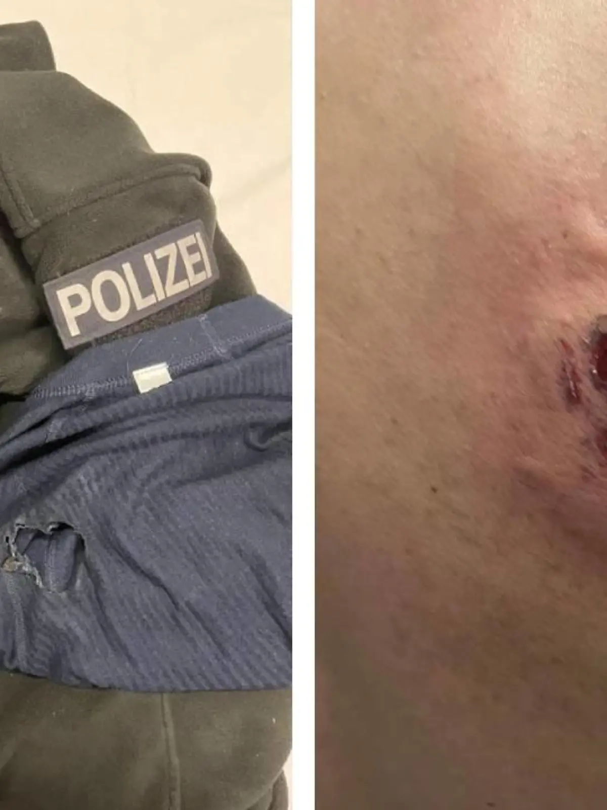 Zahlreiche Polizisten wurden in der Silvesternacht verletzt.