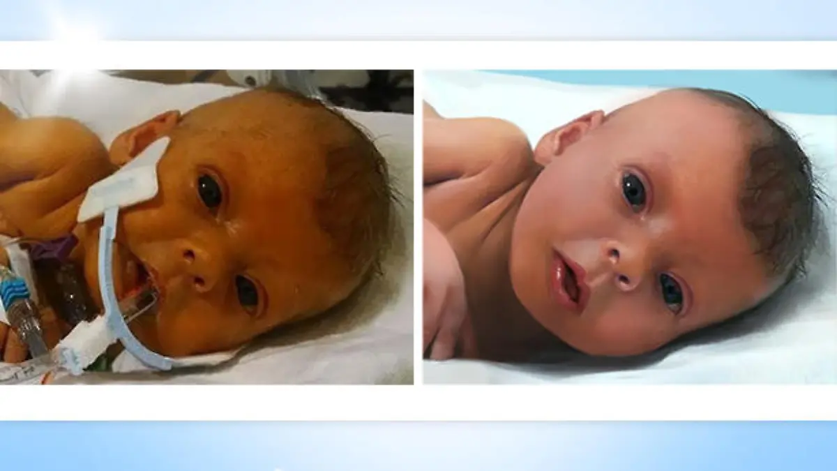Auf dem retuschierten Foto ist Sophia ganz ohne Schläuche am Körper zu sehen.
