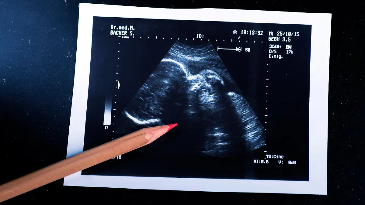 Sonografie eines Embryo im Mutterleib, 09.04.2014.