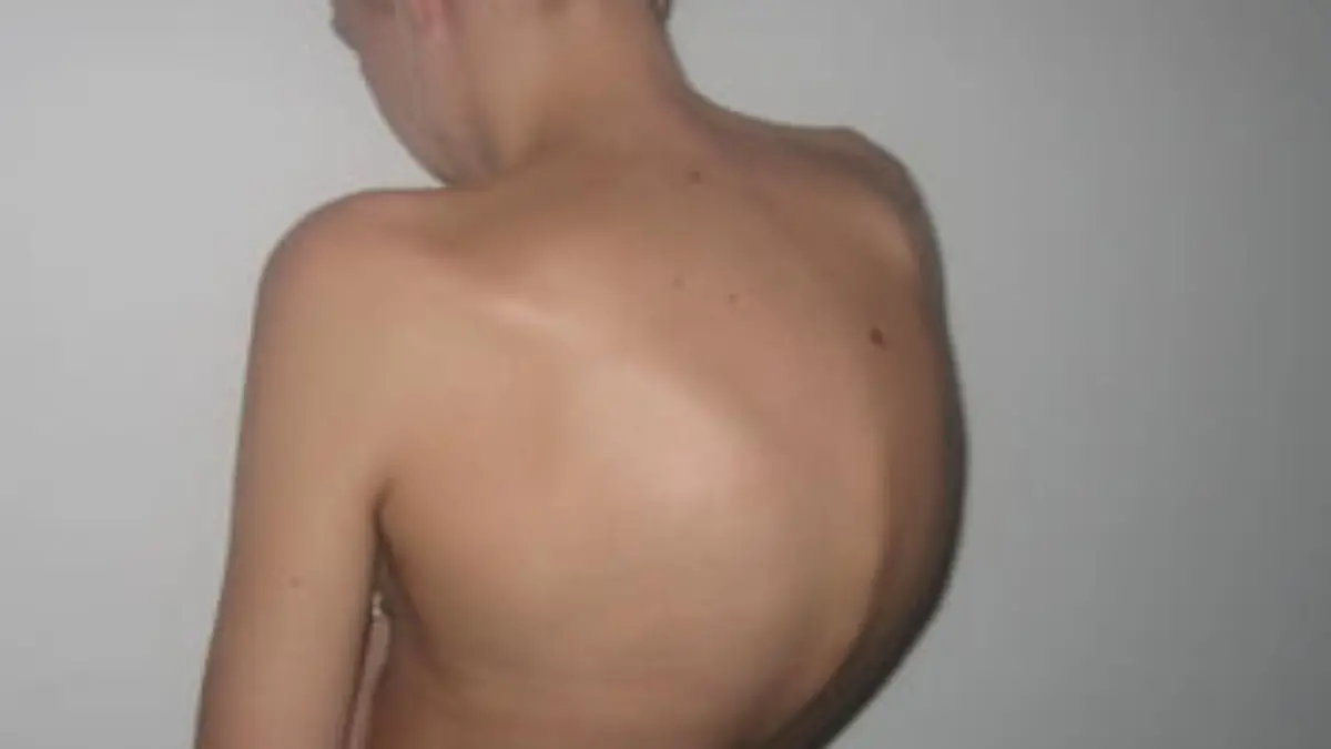 emily tropea vorher 2.jpg