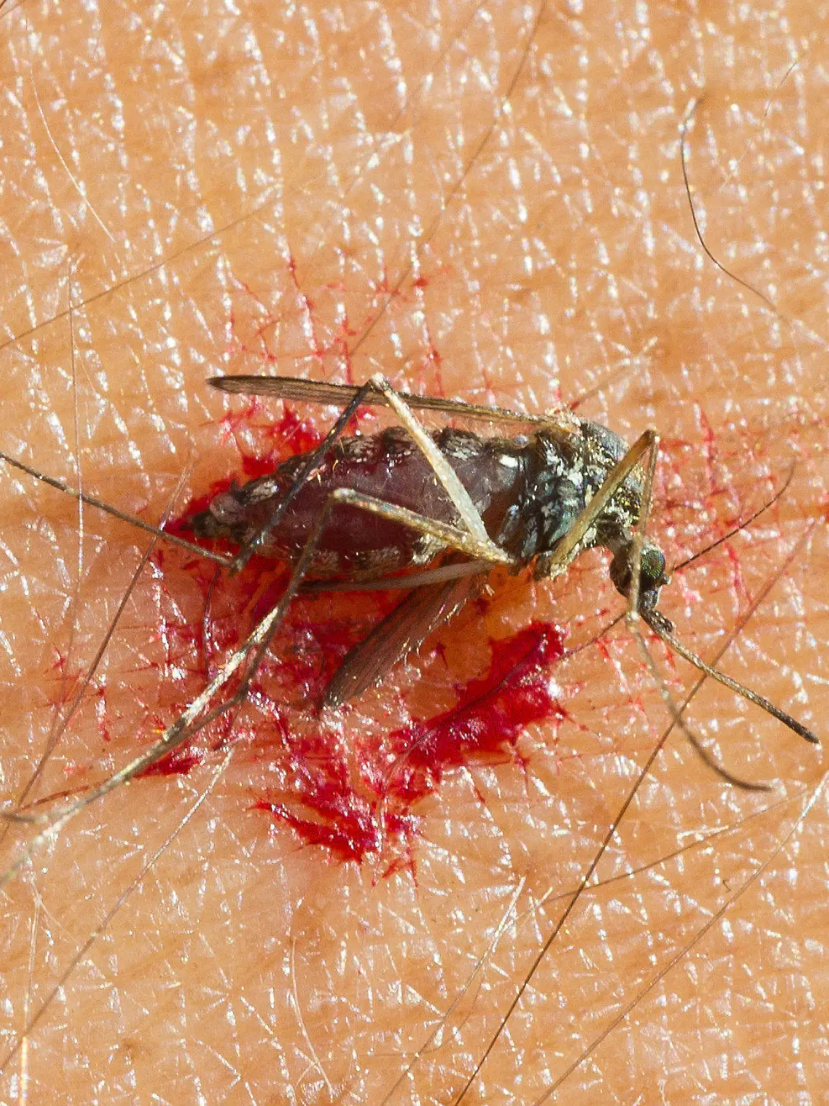 ARCHIV - Eine zerdrückte Mücke liegt im Blut auf dem Arm eines Mannes in einem Garten in Frankfurt (Oder)am 20.08.2011. Starkregen, Hochwasser und schwüle Temperaturen haben zu einer explosionsartigen Vermehrung der Mückenlarven entlang des Oberrheins geführt. Foto: Patrick Pleul dpa (zu lsw vom 20.07.2012)  +++(c) dpa - Bildfunk+++