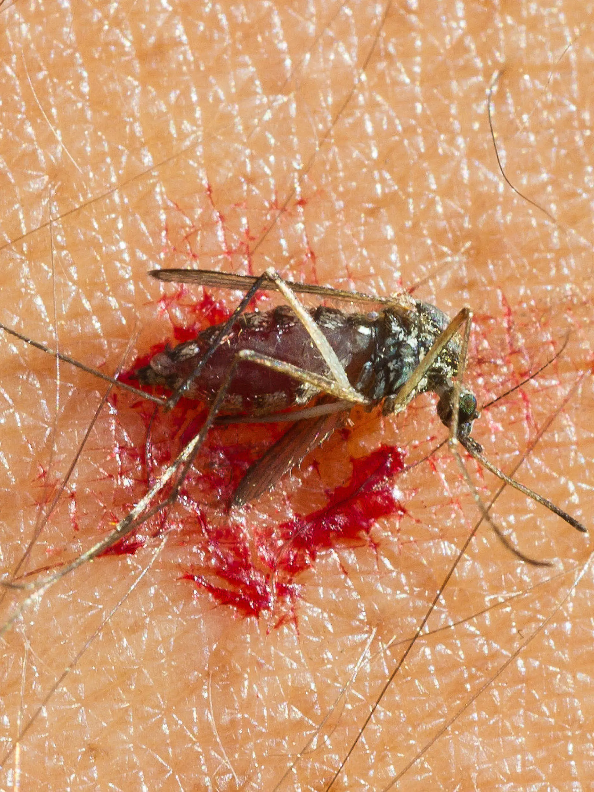 ARCHIV - Eine zerdrückte Mücke liegt im Blut auf dem Arm eines Mannes in einem Garten in Frankfurt (Oder)am 20.08.2011. Starkregen, Hochwasser und schwüle Temperaturen haben zu einer explosionsartigen Vermehrung der Mückenlarven entlang des Oberrheins geführt. Foto: Patrick Pleul dpa (zu lsw vom 20.07.2012)  +++(c) dpa - Bildfunk+++