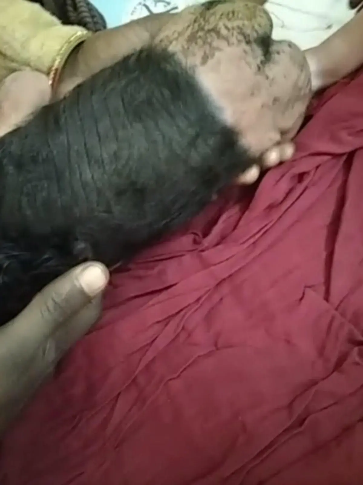 Story from Jam Press (Hairy Baby)

Pictured: The baby born with 60% of his body covered in hair.

Baby with rare condition born with over HALF his body covered in HAIR.

A woman has given birth to a baby boy with a rare condition that affects 60% of his body.

Shocking images show the newborn with thick dark locks across his entire back, head and sides of his body.

The patient, not identified, delivered her son at CHC Bawan in Hardoi, Uttar Pradesh, India.

During the seemingly normal delivery, doctors were stunned to discover the baby had so much hair.

The child was then observed by medical staff who were stumped by his condition.

Dr. Ikram Hussain diagnosed the child with giant congenital melanocytic nevus, a skin condition characterised by an abnormally dark, non-cancerous skin patch.

After the locals heard about the boy, many reached out to the family to see his rare condition for themselves.

ENDS

EDITOR'S NOTES: Video Usage Licence:(PROFESSIONAL PARTNER) We have obtained this material from a professional partner for use by our news media clients (company press release / other media agency).

Video Restrictions: None.