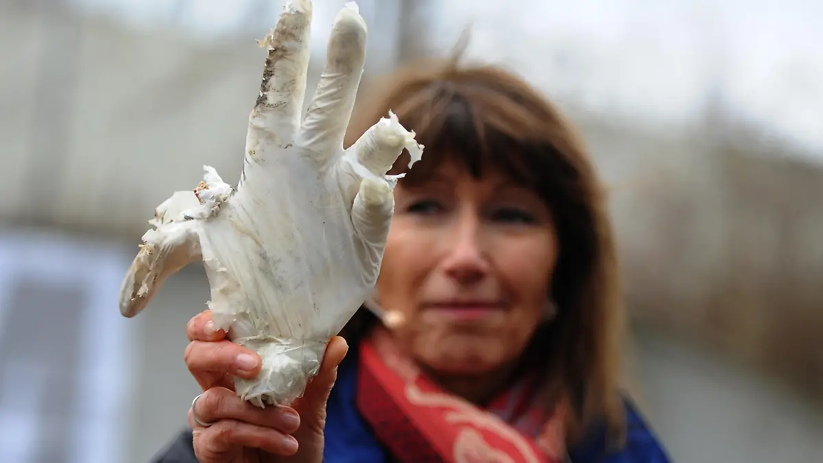 Böller zerfetzt Hand